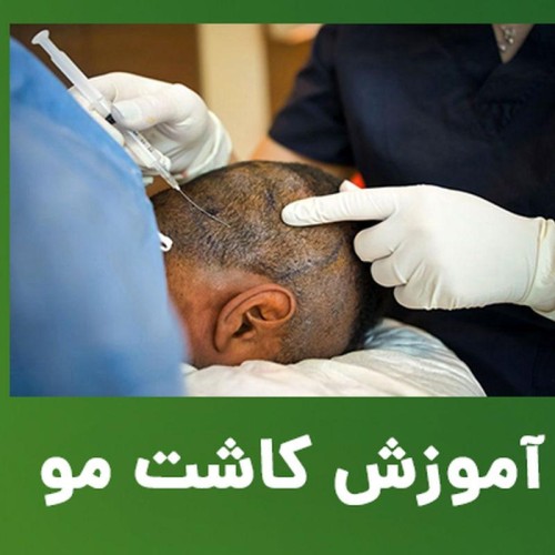 پک آموزشی follimu کاشت مو - فولیمو شماره 2
